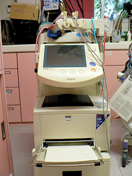 動脈硬化測定機械